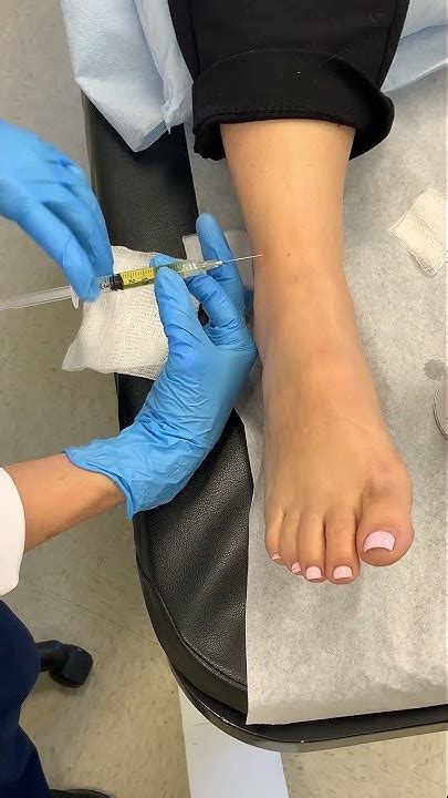 Platelet Rich Plasma Prp Injections On Ankle Youtube