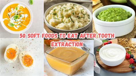 Soft Foods To Eat After Tooth Extraction