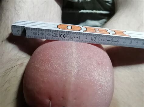 Saline Infusion In Scrotum Second Liter Nude Pics Xhamster