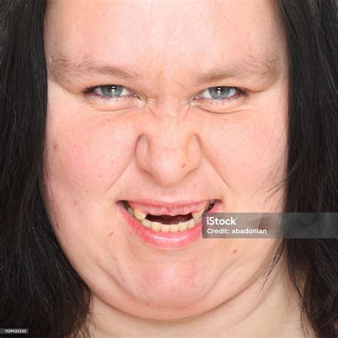 Very Ugly Woman With Missing Teeth Unhealhty Eating Person Stock Photo ...