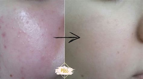 C20 Renewal: TIAM My Signature C Source Serum - Glow With Mei