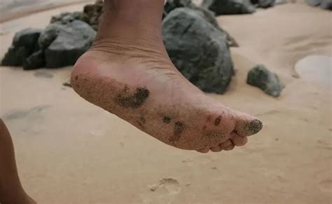 Manchas De Leo Voltam A Aparecer Em Praia De Munic Pio Baiano Bahia