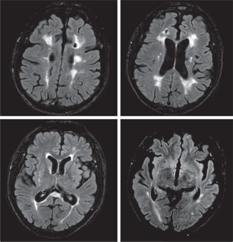 Magnetic Resonance Image Findings Download Scientific Diagram