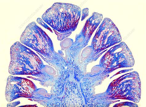 Female Pine Cone Light Micrograph Stock Image C0476188 Science