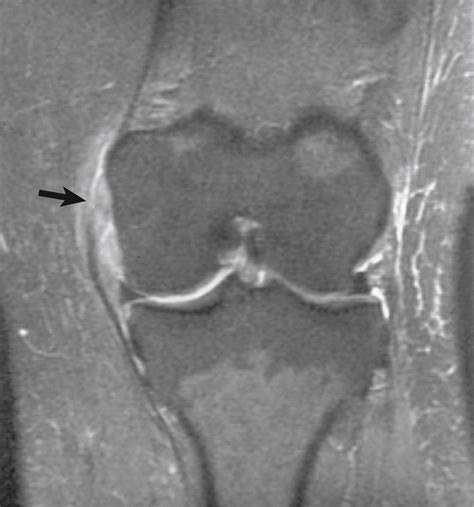 Advanced Imaging in Orthopaedics - Clinical Tree