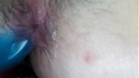 Anus Fish Free Mobile Porn Videos IPornTV