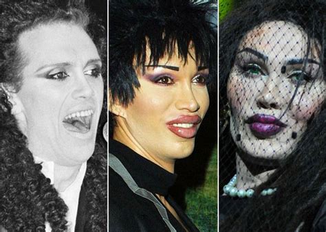 Pete Burns plastic surgery 29 – Celebrity plastic surgery online