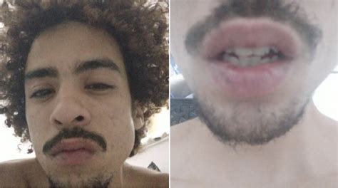 Jovem Gay Diz Ter Levado Spray De Pimenta Ao Tentar Fazer Den Ncia Em Delegacia