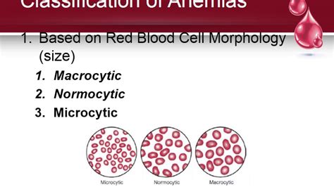 Classification And Assessment Of Anemia Youtube