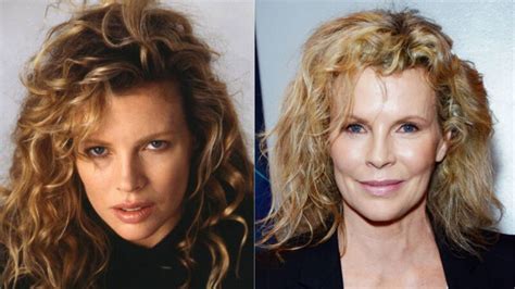 Kim Basinger S Plastic Surgery The Untold Truth