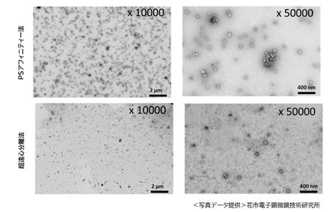 エクソソーム単離精製キット｜エクソソーム｜【ライフサイエンス】｜試薬 富士フイルム和光純薬