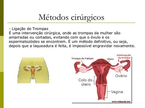 2016 Frente 2 Módulo 12 Métodos Contraceptivos