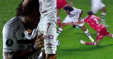 Video Marcelo Le Destroza La Pierna A Jugador De Argentinos Juniors