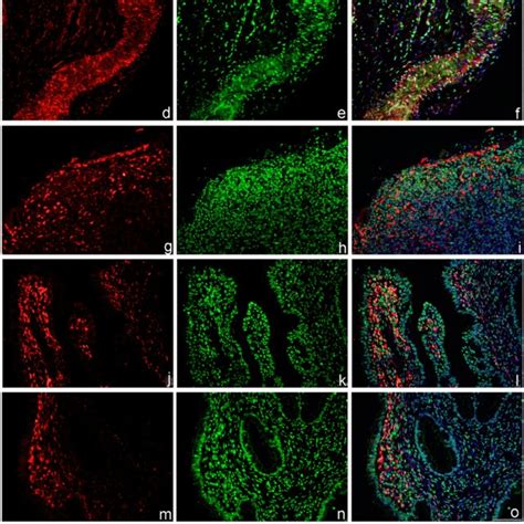 Megalin-positive cells express phosphorylated Akt-1/protein kinase B ...