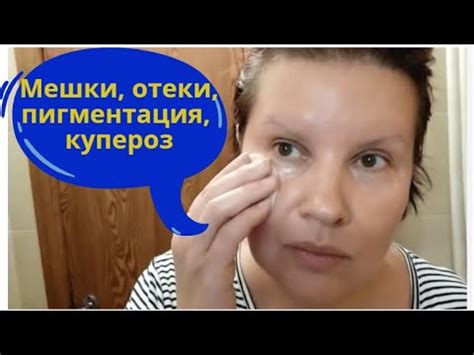 Домашний тоник для лица. От мешков, от отеков, от пигментации, от ...