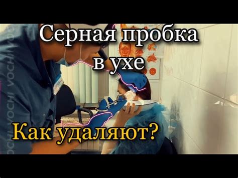 Как промыть ухо в домашних условиях от серных пробок