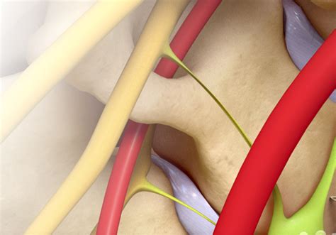 Cervical Lysis Racz EDU