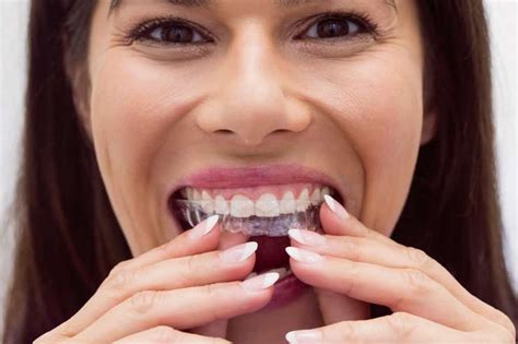 Best Invisible Braces And Invisalign Treatment In Kolkata Dental World