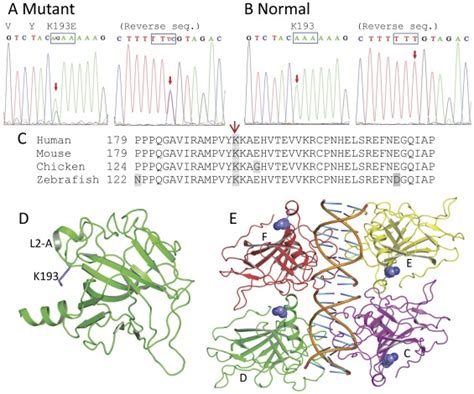 A A Missense Mutation K193e Of P63 Dbd In The Proband With