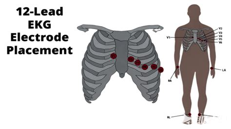 12 Lead ECG Placement Female: How to Position Leads on Women Patients