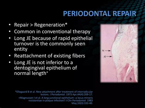 Periodontal regeneration current concepts | PPTX