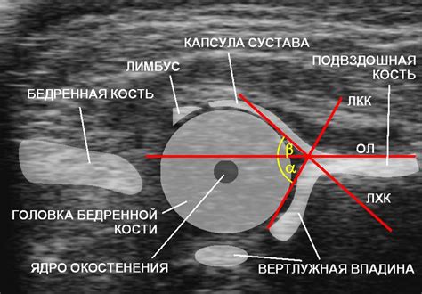 УЗИ тазобедренного сустава детям в медицинском центре Гераци