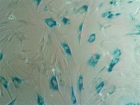 Adult Stem Cells — Aelan Cell Technologies