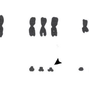 Pdf Evolution Of Reptile Sex Chromosomes