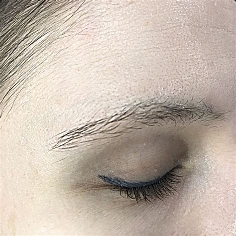 Удалить лазером или ремувером? - Перманентный макияж