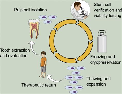 banking  teeth stem cells   dental office pmc