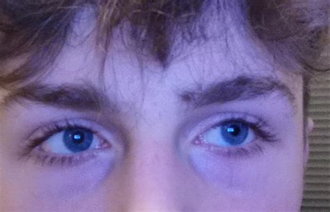 how to fix eyebags