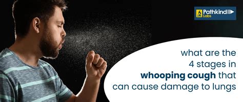 Whooping Cough Symptoms And Treatment