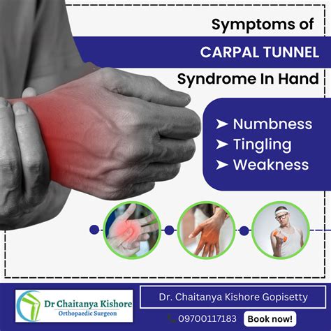 Carpal Tunnel Syndrome Cts Carpal Tunnel Syndrome Cts Is A By Drchaitanyakishore Sep