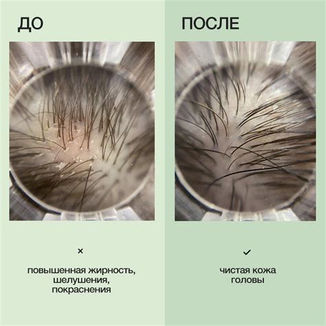 Детокс-шампунь Detox Oily Hair Cleansing Shampoo