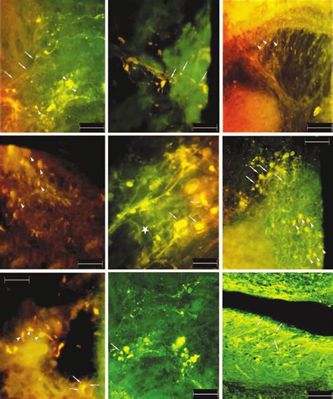 Photomicrographs Of Parts Of The Salmon Brain Slices Containing