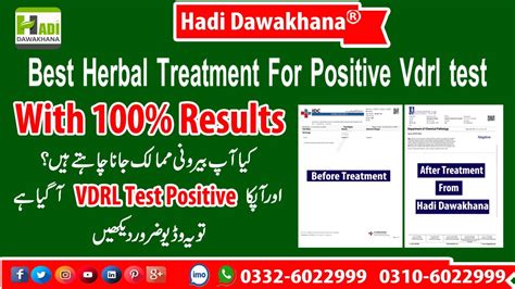 Vdrl Blood Test For Syphilis Vdrl Test Kya Hota Hai Atshik Ka Ilaj