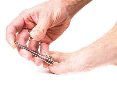 How to Get Rid of an Ingrown Toenail with These 8 Home Remedies