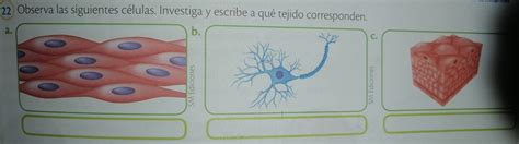 Observa Las Siguientes C Lulas Investiga Y Escribe A Qu Tejido