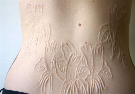 Следы которые оставляют люди чаще всего оказываются шрамами - фото ...