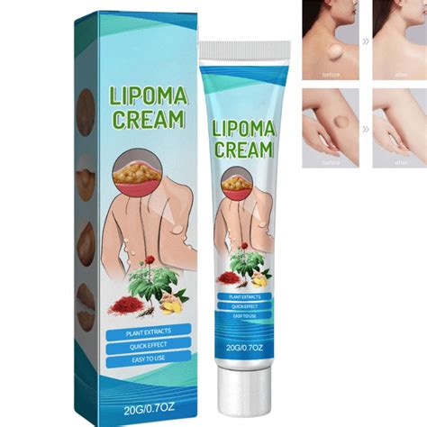 Qasha Magical Lipoma Elimination Cream Removal Relieving Subcutaneous