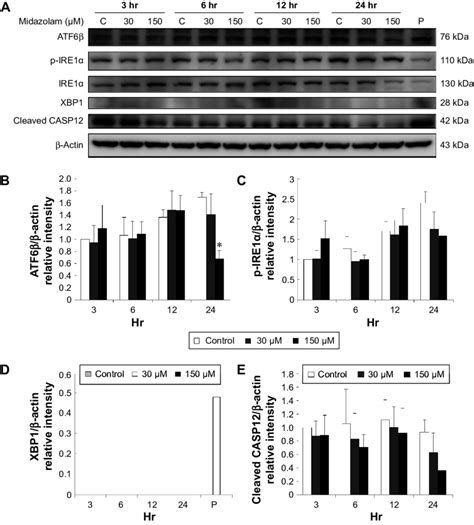 The Involvement Of Endoplasmic Reticulum Stress Pathways In