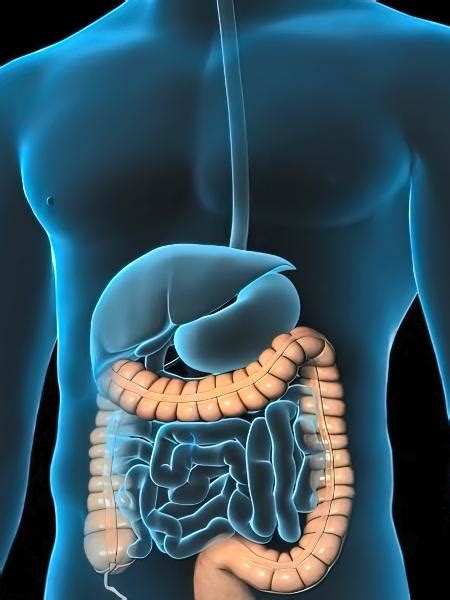 Mortalidade por câncer colorretal cresce na América Latina