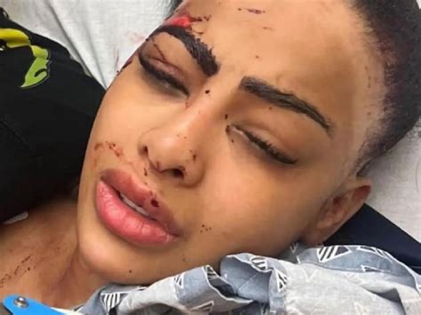 Yailin La Más Viral aparece golpeada en la cara qué le pasó