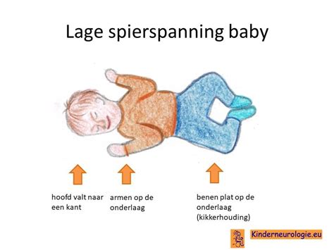 Het foetaal alcohol syndroom - Kinderneurologie