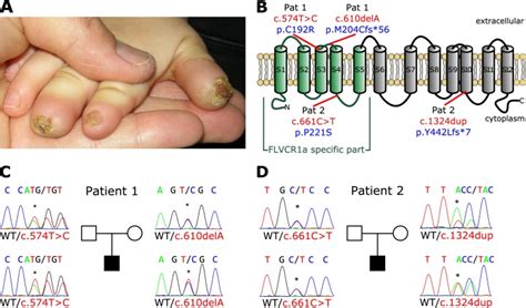 Mutations In The Heme Exporter Flvcr Cause Sensory Neurodegeneration