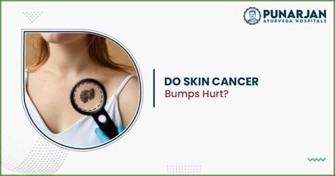 Do Skin Cancer Bumps Hurt? | Punarjan Ayurveda Hospitals