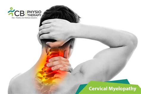 What Is Cervical Myelopathy?, Symptoms ,Causes, Diagnosis & Physiotherapy Treatment Of Cervical ...