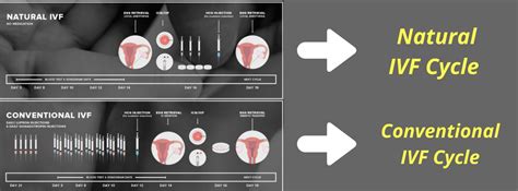 Differences Between Natural Ivf Cycle And Conventional Ivf Cycle