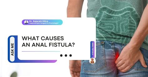 What Does An Anal Fistula Look Like