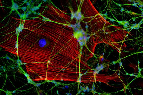 Medical School Specimen Neuronal Culture Technique